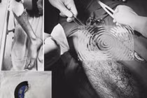 Xử lý đúng cách tai nạn lao động, bảo tồn chi thể, tránh hậu quả nghiêm trọng