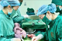 Chuyển dạ, buồn nôn... thai phụ viêm tụy cấp nguy kịch vì mỡ máu