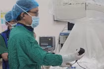 Thực hiện thành công ca tán sỏi túi mật xuyên gan qua da