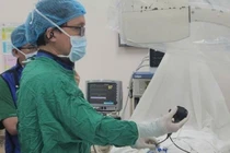 Thực hiện thành công ca tán sỏi túi mật xuyên gan qua da