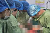 Cô gái Hà Nội vỡ tử cung vì tự uống thuốc phá thai tại nhà