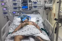 Trẻ 9 tuổi đa chấn thương, sốc mất máu, lóc da diện rộng được cứu sống