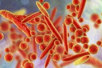 Xét nghiệm vi khuẩn Mycoplasma phát hiện sớm nhiễm khuẩn hô hấp