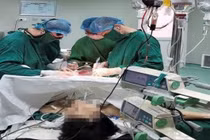 Truyền 10 đơn vị máu cứu thanh nhiên 27 tuổi vỡ gan, sốc mất máu