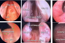 Kỹ thuật chữa bệnh lý tuyến tiền liệt 'xịn' nhất hiện nay