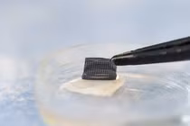 Phát minh mới, miếng dán phát hiện ung thư da không xâm lấn