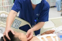 Nhặt được vật lạ để nghịch trẻ 9 tuổi nguy kịch từ kíp nổ tự chế