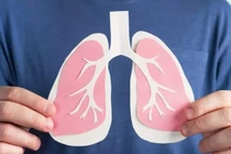 Hà Nội ô nhiễm cao, những thực phẩm vàng cho lá phổi khỏe mạnh