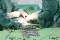 Khối u nang buồng trứng khủng chèn ép nội tạng cụ bà 98 tuổi