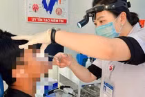 Gắp con đỉa dài 5cm ký sinh trong mũi người đàn ông