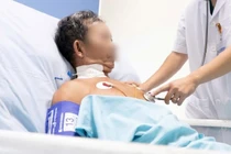 Người đàn ông nguy kịch vì bị ong vò vẽ đốt 30 vết