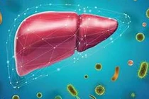 Con đường lây nhiễm viêm gan B, phòng tránh thế nào?