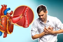 Bệnh 'sát thủ thầm lặng' ít dấu hiệu cảnh báo, hậu quả rất nặng