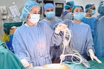 Đau bụng âm ỉ, người bệnh 64 tuổi mắc hai ung thư cùng lúc