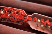 Chuyên gia mách cách làm sạch mạch máu cho cơ thể khỏe mạnh