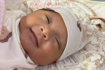 8 tuần giữ thai đầy nỗ lực cho sản phụ cạn ối, xoắn dây rốn, tim thai kém