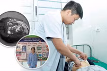 Chữa u nang lách khổng lồ thành công cho bệnh nhi tại Nghệ An