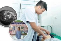 Chữa u nang lách khổng lồ thành công cho bệnh nhi tại Nghệ An