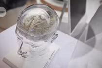 Quên Neuralink đi, chip não này làm được điều mà Elon Musk thèm muốn