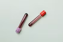 Nhật Bản tạo máu nhân tạo 'vạn năng', không cần làm lạnh 