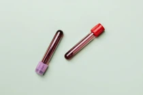 Nhật Bản tạo máu nhân tạo 'vạn năng', không cần làm lạnh 