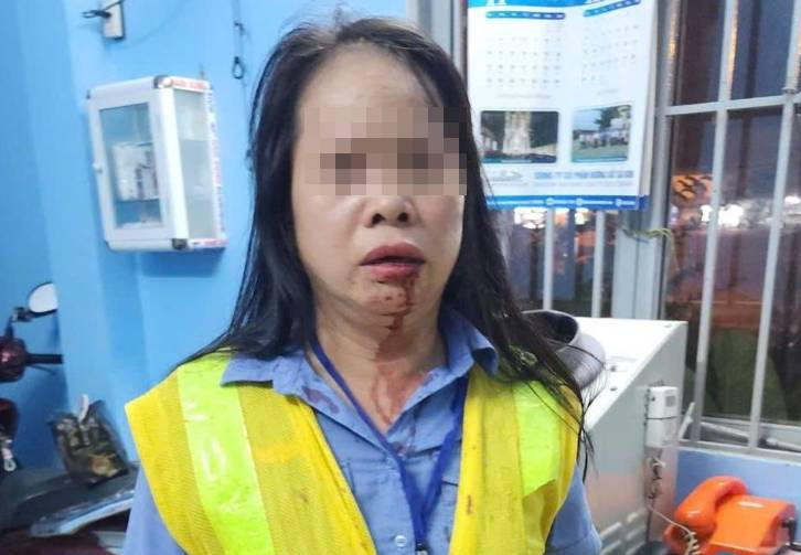 Vấn đề pháp lý vụ nhân viên gác tàu bị đánh gãy xương mũi Van de phap ly vu nhan vien gac tau bi danh gay xuong mui