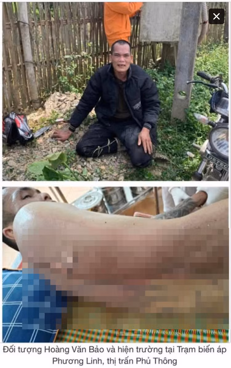 Trom day dien, hai nguoio Bac Kan bi dien giat bong nang-Hinh-2