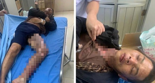 Trom day dien, hai nguoio Bac Kan bi dien giat bong nang