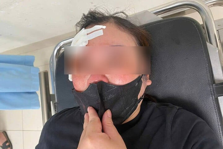 Nguoi phu nu bi tai xe dung dui cui vut vao dau