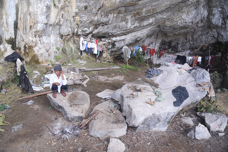 Toc nguoi bi an nhat Viet Nam, dung 'phep thuat' de tranh thai-Hinh-4