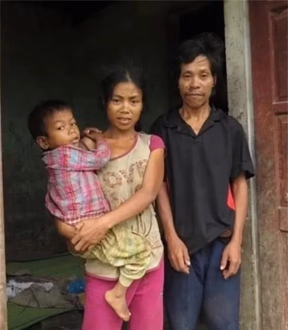 Toc nguoi bi an nhat Viet Nam, dung 'phep thuat' de tranh thai-Hinh-2