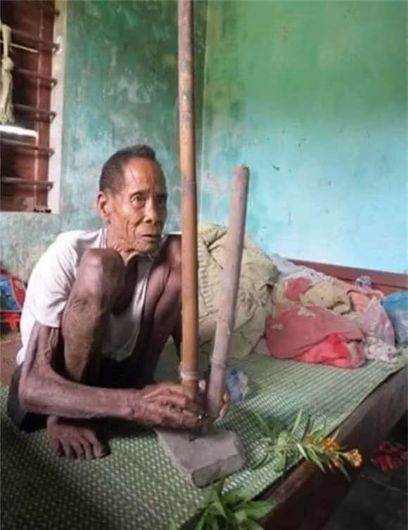 Toc nguoi bi an nhat Viet Nam, dung 'phep thuat' de tranh thai-Hinh-3