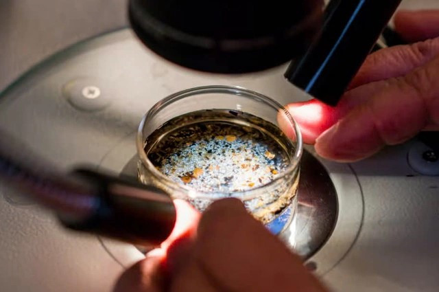 Phat hien vi nhua trong dich nang buong trung gay chan dong