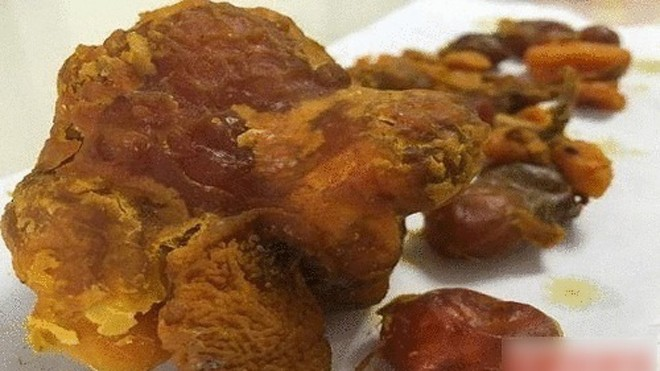 Mo bung ga thay “di vat”, nhieu nguoi tranh nhau tra gia hang chuc ty-Hinh-3