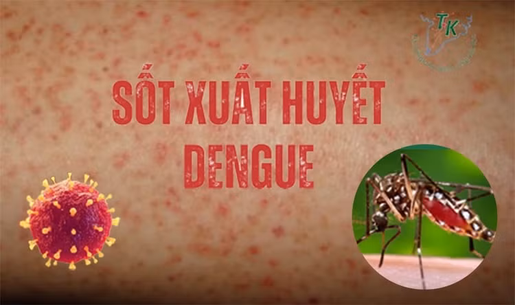 Nguy co sot xuat huyet Dengue bung phat