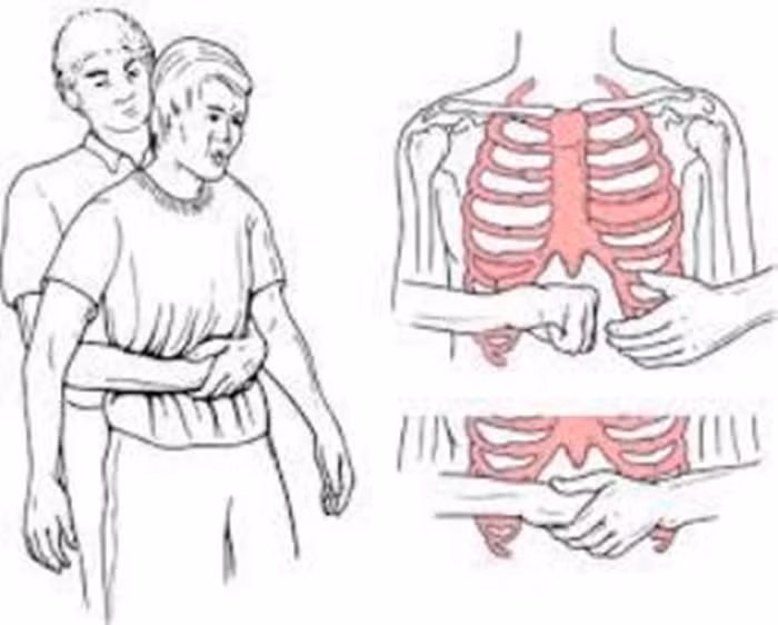 Be trai 3 tuoi tu vong thuong tam do hoc keo hinh con mat-Hinh-2