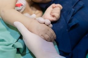 VINMEC ghep gan thanh cong cho benh nhi 8 thang tuoi-Hinh-5