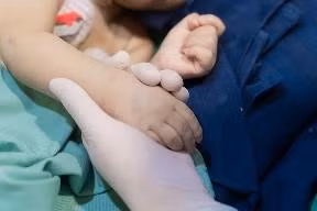 VINMEC ghep gan thanh cong cho benh nhi 8 thang tuoi-Hinh-5