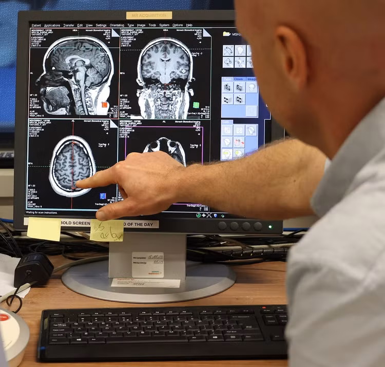 Giai ma bi an ve chuc nang va kha nang ket noi cua nao bo-Hinh-2