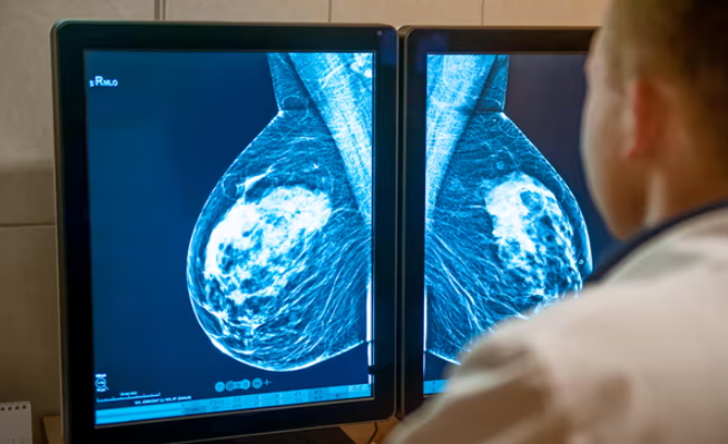 Anh cap phep su dung thuoc dieu tri ung thu vu moi