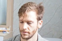 Nghi phạm người nước ngoài cướp tiệm vàng Đà Nẵng - xử lý sao?