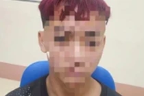 Thiếu niên 15 tuổi hiếp dâm bé 12 tuổi ở Lào Cai sẽ bị xử lý ra sao?