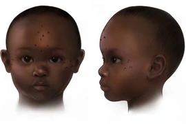 Khám phá hình xăm cổ đại trên xác ướp trẻ em ở Sudan