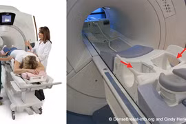 Công nghệ AI cải tiến chẩn đoán ung thư bằng MRI nhanh hơn, chính xác hơn