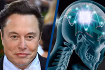 Neuralink của Elon Musk lập kỷ lục cấy chip não 1,5 giây