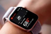 Apple Watch phát hiện đột quỵ sớm hơn khám?