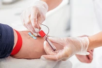 Hoang mang chiêu lừa mới nhắm vào người hiến máu