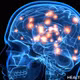 Hy vọng mới trong điều trị Parkinson với liệu pháp tế bào gốc chỉnh sửa gene