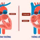 Tim bẩm sinh thông liên nhĩ ở người lớn điều trị thế nào?
