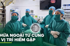 Chửa ngoài tử cung 'ẩn' giữa hai lớp dây chằng rộng